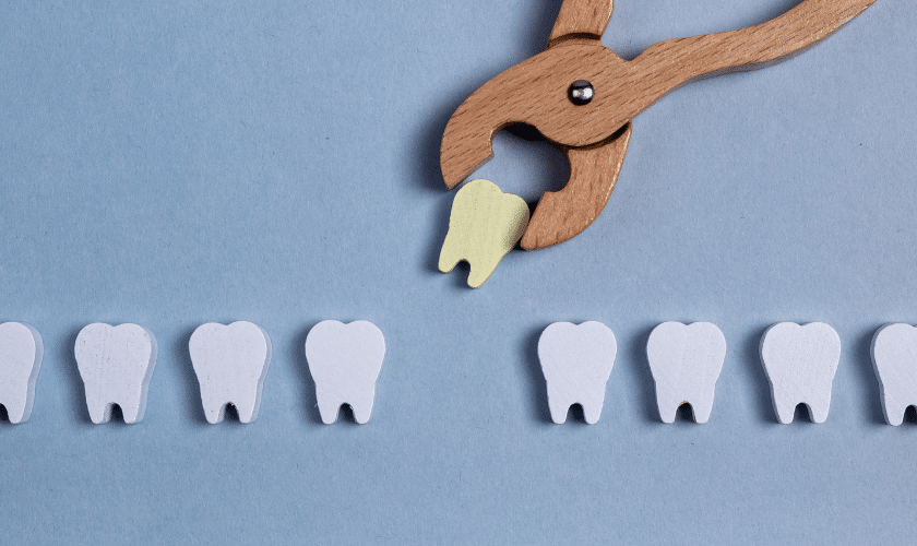 Tooth Extraction Process Types, Aftercare and More