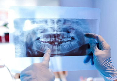 digital x-rays and imaging