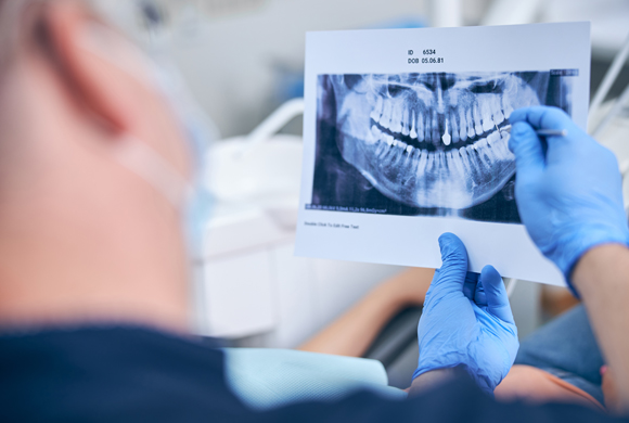 Digital X-Rays Phoenix