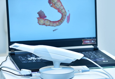 Intraoral Scanner