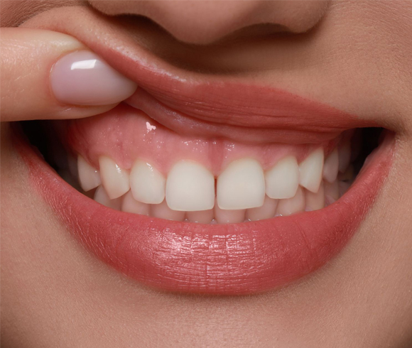 Periodontal Care in Phoenix, AZ