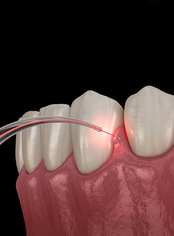 laser dentistry Phoenix AZ