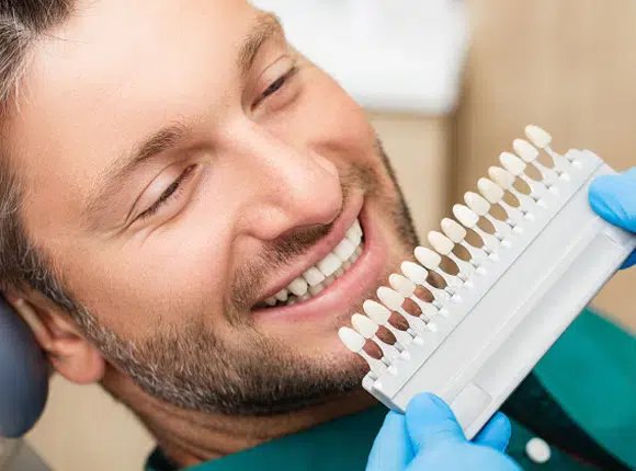 veneers in Phoenix, AZ