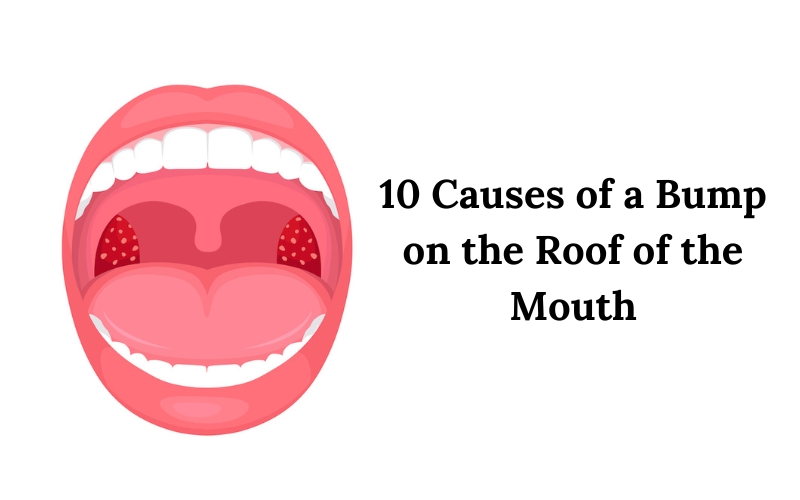 why you might have bumps on the roof of your mouth