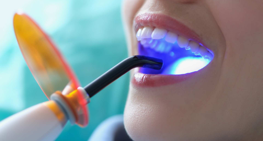 types of teeth whitening treatments