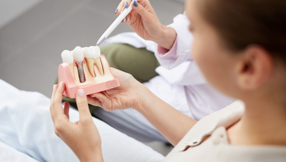 dental implants for young adults