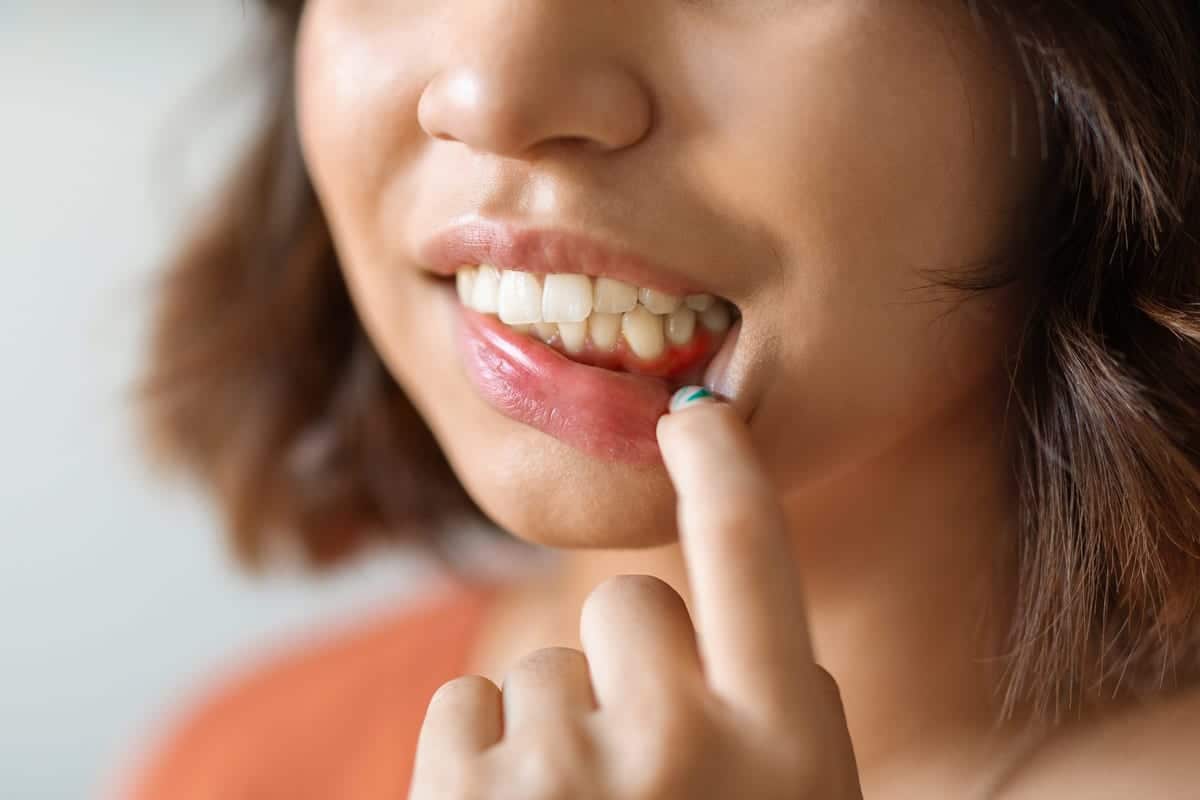 Periodontal Care in Phoenix